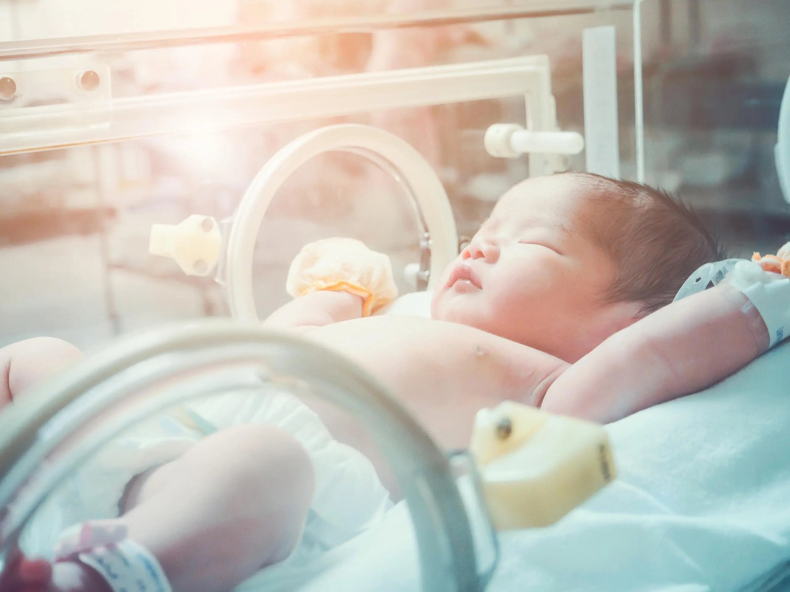 About NICU (Neonatal Intensive Care Unit)